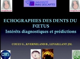 Échographies des dents du fœtus - Intérêts diagnostiques etprédictions Échographies des dents du fœtus - Intérêts diagnostiques etprédictions
