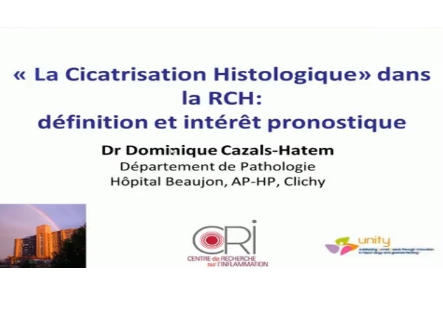 Cicatrisation muqueuse histologique dans la RCH - Définition et intérêt pronostique Cicatrisation muqueuse histologique dans la RCH - Définition et intérêt pronostique