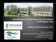 Classification of Flap Suturing and 45-Degree Test for Endoscopic Dacryocystorhinostomy Classification of Flap Suturing and 45-Degree Test for Endoscopic Dacryocystorhinostomy