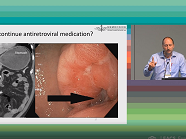 Clinical case 2 - Administration of drugs through feeding tube & absorption/DDIs issues Clinical case 2 - Administration of drugs through feeding tube & absorption/DDIs issues