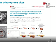 Clinical view on pediatric and adult cardiomyopathy Clinical view on pediatric and adult cardiomyopathy