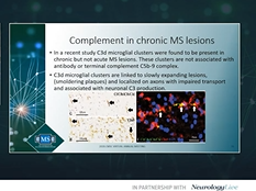CMSC 2020 Day 4: Horea Rus, MD, PhD, on the Role of Complement in MS CMSC 2020 Day 4: Horea Rus, MD, PhD, on the Role of Complement in MS