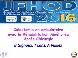 Colectomie en ambulatoire avec la réhabilitation améliorée après chirurgie