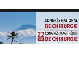 Colectomie gauche et anevrysme de l'aorte Colectomie gauche et anevrysme de l'aorte