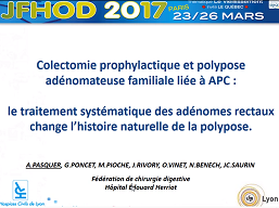 Colectomie prophylactique chez les patients atteints de polypose adénomateuse familiale liée à APC : le traitement systématique des adénomes du rectum change l'histoire naturelle de la polypose