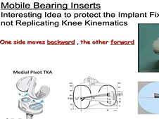 Collateral ligaments laxities and balance in total knee arthroplasty