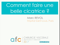 Comment faire une belle cicatrice ?