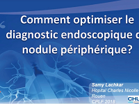 Comment optimiser le diagnostic dun nodule pulmonaire ? (navigation, minisonde) Comment optimiser le diagnostic dun nodule pulmonaire ? (navigation, minisonde)