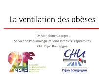 Comment ventiler un sujet obèse ?