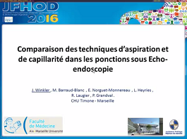 Comparaison des techniques d'aspiration et de capillarité dans la ponction sous échoendoscopie Comparaison des techniques d'aspiration et de capillarité dans la ponction sous échoendoscopie