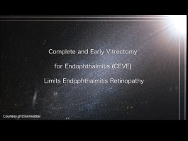 Complete and Early Vitrectomy for Endophthalmitis Limits Endophthalmitis Retinopathy Complete and Early Vitrectomy for Endophthalmitis Limits Endophthalmitis Retinopathy