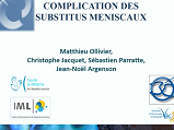 Complication des substituts méniscaux Complication des substituts méniscaux