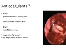 Complications of Acute Sinusitis