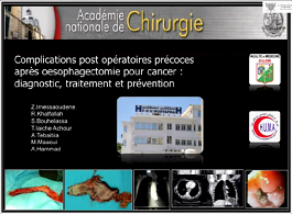 Complications post opératoires précoces après oesophagectomie pour cancer : diagnostic, traitement et prévention. Complications post opératoires précoces après oesophagectomie pour cancer : diagnostic, traitement et prévention.