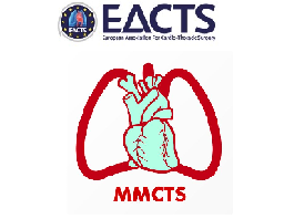Composite LITA-RITA-Y (LIMA-RIMA-Y) for coronary artery bypass grafting
