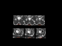 Computational Fluid Dynamics Simulations of Male Voiding