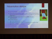 Conduites à tenir devant une fracture des épines tibiales