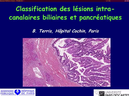 Conférence : Classification des lésions intracanalaires biliaires et pancréatiques Conférence : Classification des lésions intracanalaires biliaires et pancréatiques