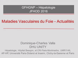 Conférence : Maladies vasculaires du foie : actualités
