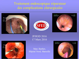Conférence : Réparation endoscopique des complications chirurgicales