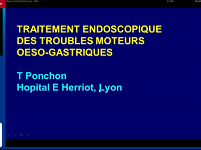 Conférence : Traitement endoscopique des troubles moteurs oeso-gastriques