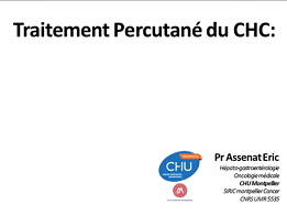 Conférence : Traitement percutané du CHC