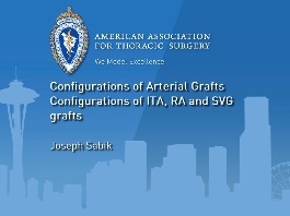 Configuration des greffons artériels - Configurations des greffes de veine saphène, de l’artère thoracique interne, et de l'artère radiale Configuration des greffons artériels - Configurations des greffes de veine saphène, de l’artère thoracique interne, et de l'artère radiale