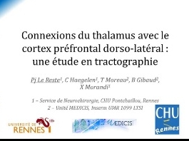 Connexions entre le thalamus et le cortex préfrontal dorso-lateral