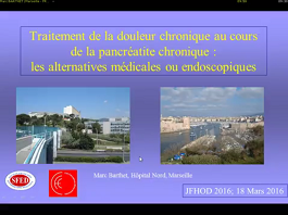 CONTRE : Les alternatives médicales ou endoscopiques : indications, résultats