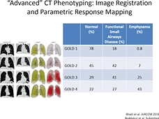 COPD in the 21st Century