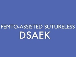 Cornée, Pathologies externes - Évaluation de la topographie cornéenne, astigmatisme avec utilisation de colle tissulaire DSAEK Cornée, Pathologies externes - Évaluation de la topographie cornéenne, astigmatisme avec utilisation de colle tissulaire DSAEK