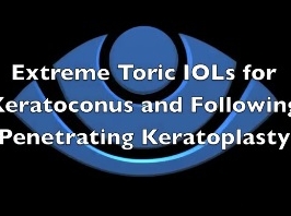 Cornée, Pathologies externes - Lentille intraoculaire torique pour kératocône et kératoplastie Cornée, Pathologies externes - Lentille intraoculaire torique pour kératocône et kératoplastie