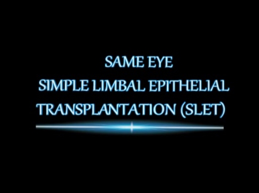Cornea, External Disease - Ipsilateral Simple Limbal Epithelial Transplantation Cornea, External Disease - Ipsilateral Simple Limbal Epithelial Transplantation