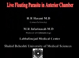 Cornée, Pathologies externes - Larve flottante dans la chambre intérieure de l'oeil Cornée, Pathologies externes - Larve flottante dans la chambre intérieure de l'oeil