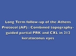 Cornée, Pathologies externes - Suivi à long terme du protocole d'Athènes : PRK partielle de la topographie guidée combinée et CXL dans 212 yeux atteints de kératocônes Cornée, Pathologies externes - Suivi à long terme du protocole d'Athènes : PRK partielle de la topographie guidée combinée et CXL dans 212 yeux atteints de kératocônes