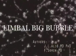 Cornée, Pathologies externes - Nouvelle technique pour la création d'une grosse bulle pour la kératoplastie lamellaire antérieure profonde Cornée, Pathologies externes - Nouvelle technique pour la création d'une grosse bulle pour la kératoplastie lamellaire antérieure profonde