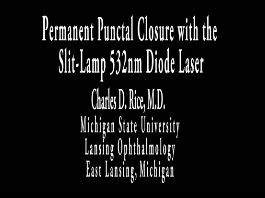 Cornée, Pathologies externes - Fermeture permanente des canaux lacrimaux avec une lampe à fente diode laser (532-nm)