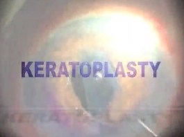 Cornée, Pathologies externes - Kérathoplastie endothéliale pré-Descemet