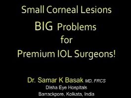 Cornée, Pathologies externes - Petites lésions de la cornée : gros problèmes pour les chirurgiens intraoculaires! Cornée, Pathologies externes - Petites lésions de la cornée : gros problèmes pour les chirurgiens intraoculaires!