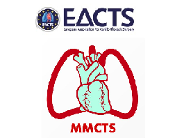 Correction of pectus excavatum using the modified Nuss procedure