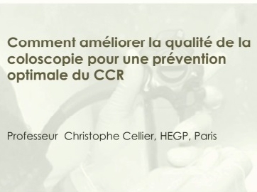 Critères de qualité de la coloscopie et prévention du cancer colo-rectal Critères de qualité de la coloscopie et prévention du cancer colo-rectal