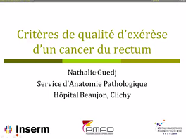 Critères de qualité d'exérèse d'un cancer du rectum