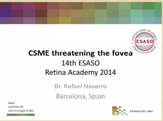CSME threating the fovea but not thickening the centre point CSME threating the fovea but not thickening the centre point