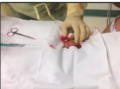 Cysts & Surgery? Best of Dr. ER! Please Subscribe!