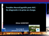 Démence post-AVC : du diagnostic à la prise en charge