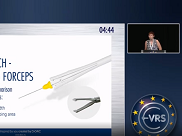 D.O.R.C. Dutch Ophthalmic Research Center