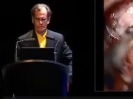 Déroutes opératoires (10/10) - Anévrismes du segment M1 a branche frontale