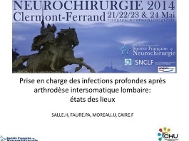 Déroutes opératoires (3/10) - Prise en charge des infections profonde après arthrodèse intersomatique lombaire