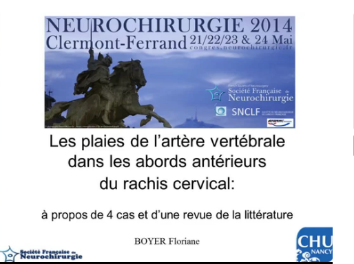 Déroutes opératoires (5/10) - Les plaies de l'artère vertébrale dans les voies d’abord antérieures du rachis cervical