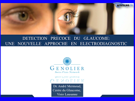 Détection précoce du glaucome : une nouvelle approche en électrodiagnostic